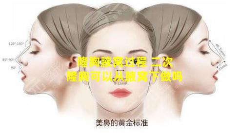 隆胸腋窝过程 二次隆胸可以从腋窝下做吗